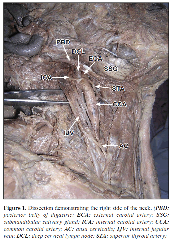 anatomical-variations-Dissection-demonstrating