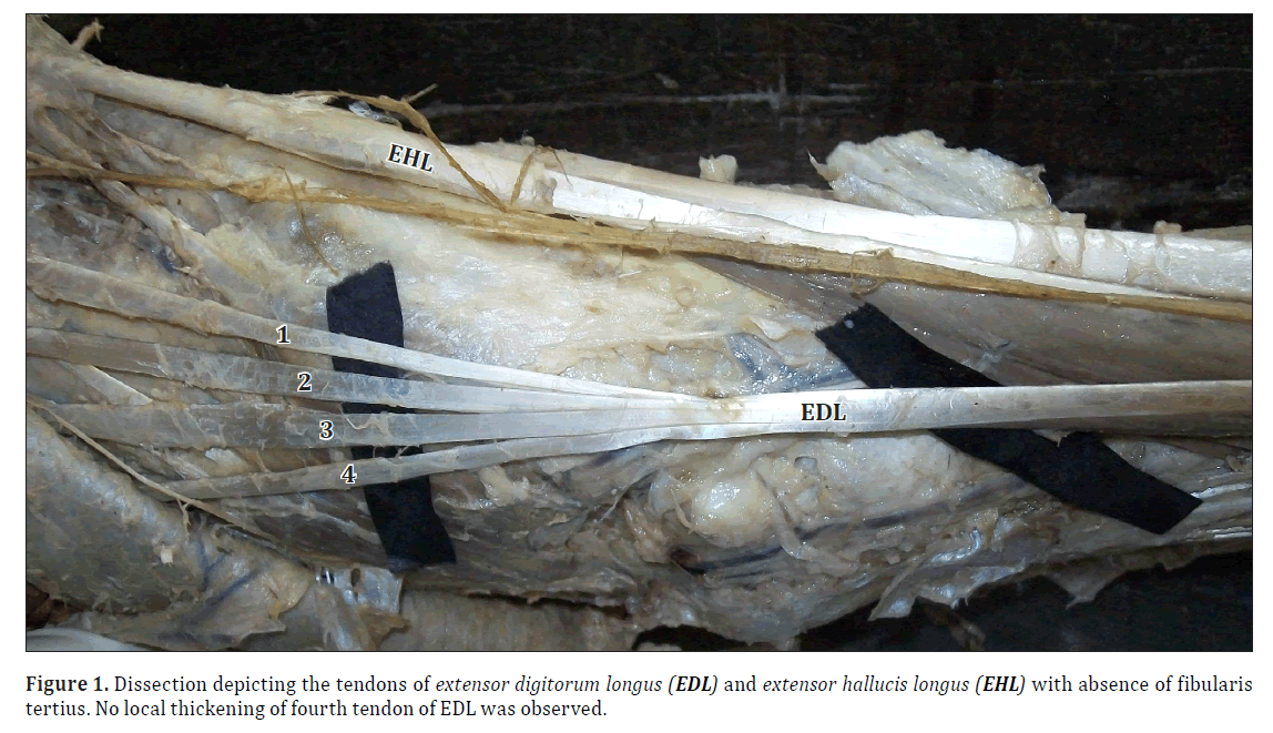 anatomical-variations-Dissection-depicting