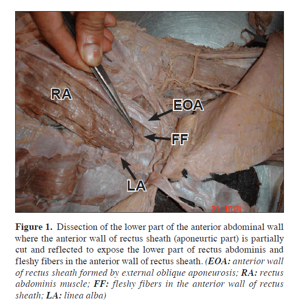 anatomical-variations-Dissection-lower