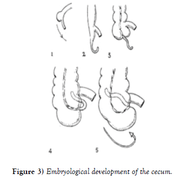 anatomical-variations-Embryological-development