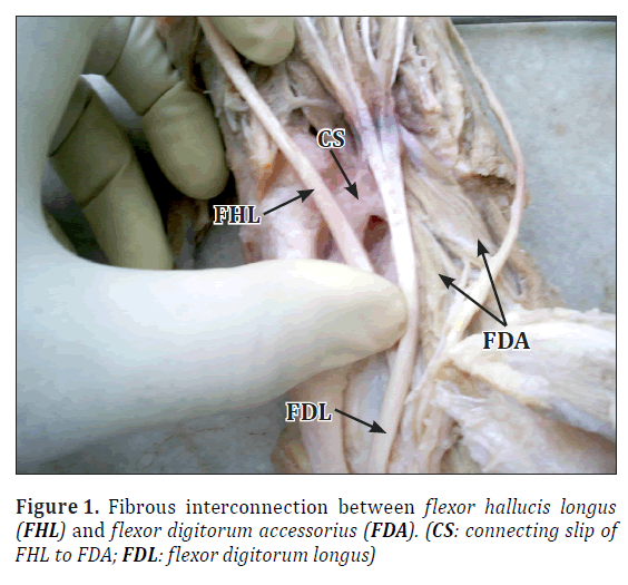 anatomical-variations-Fibrous-interconnection