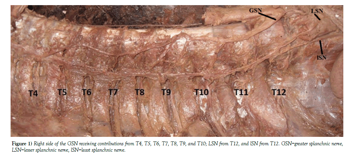 anatomical-variations-GSN-receiving