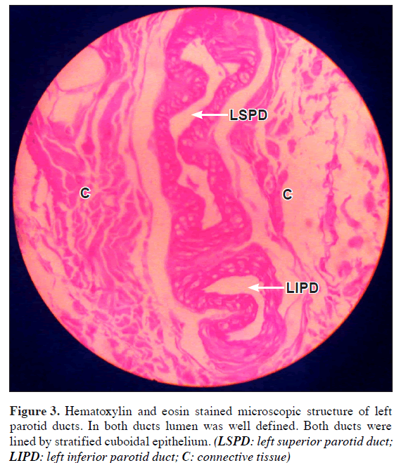 anatomical-variations-Hematoxylin-eosin