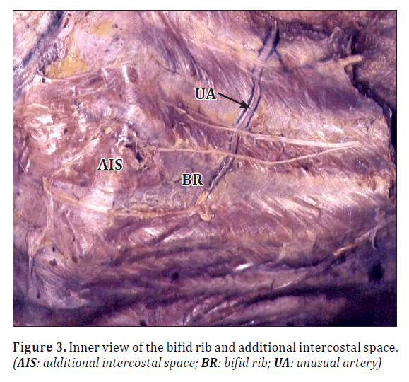 anatomical-variations-Inner-view
