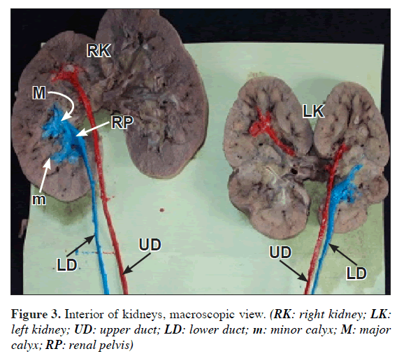 anatomical-variations-Interior-kidneys