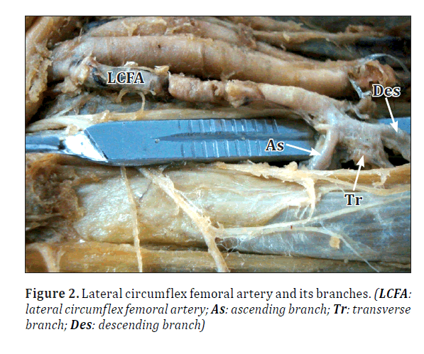 anatomical-variations-Lateral-circumflex