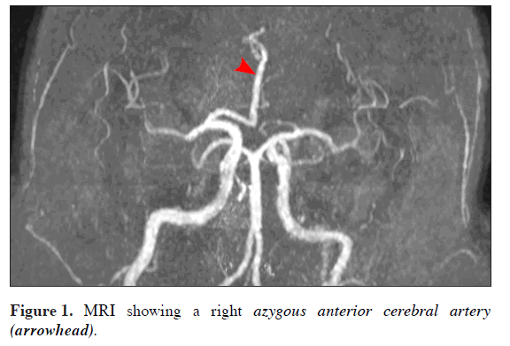 anatomical-variations-MRI-showing