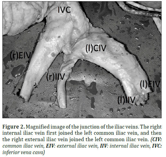 anatomical-variations-Magnified-image