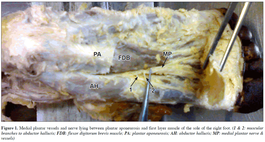 anatomical-variations-Medial-plantar-vessels