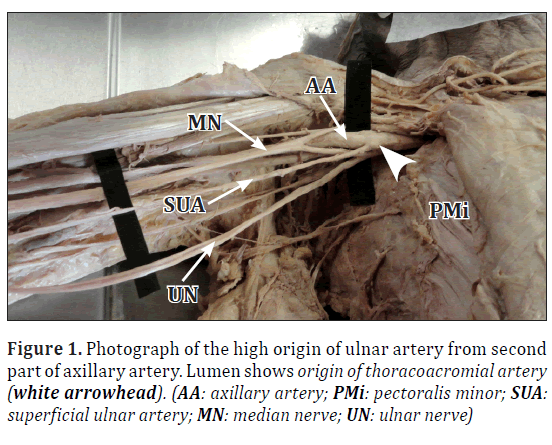 anatomical-variations-Photograph-high