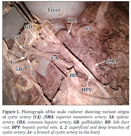 anatomical-variations-Photograph-male