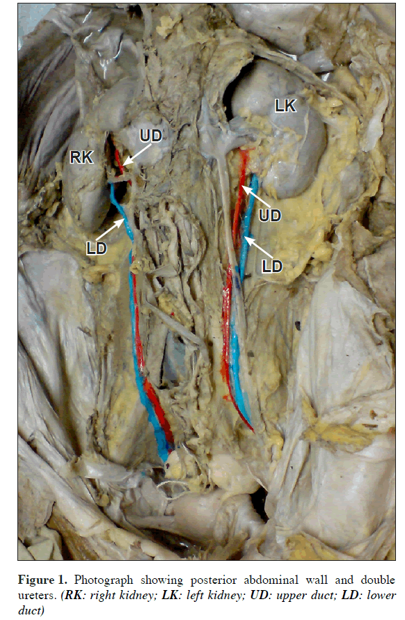anatomical-variations-Photograph-showing