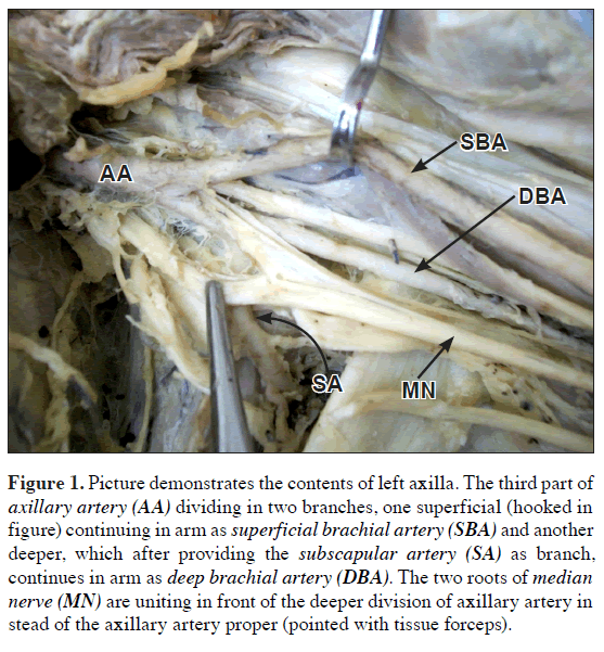 anatomical-variations-Picture-demonstrates