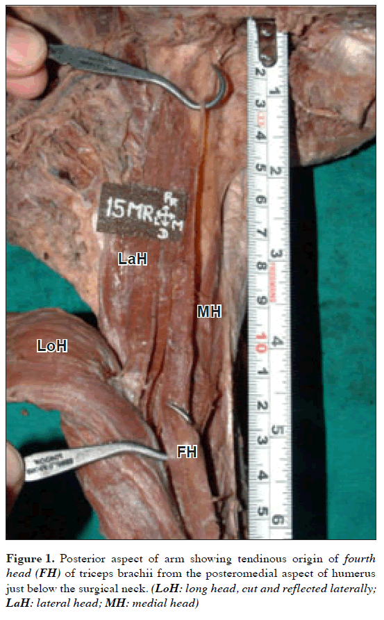 anatomical-variations-Posterior-aspect