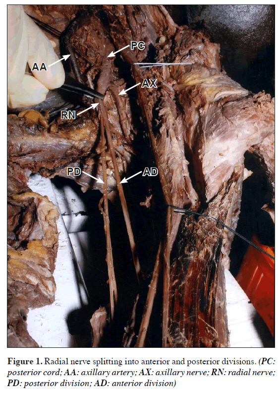 anatomical-variations-Radial-nerve