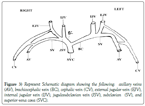 anatomical-variations-Schematic-diagram