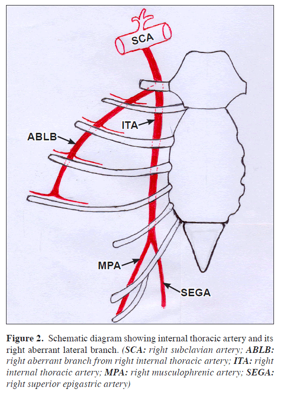 anatomical-variations-Schematic-diagram