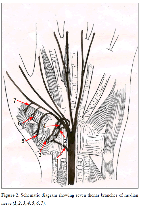 anatomical-variations-Schematic-diagram