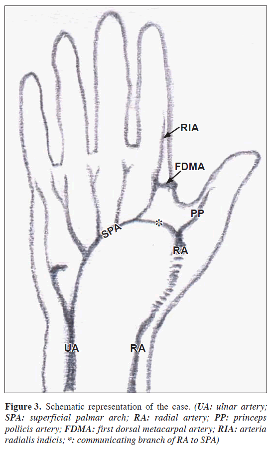 anatomical-variations-Schematic-representation