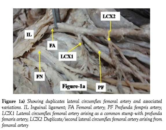 anatomical-variations-Showing-duplicate