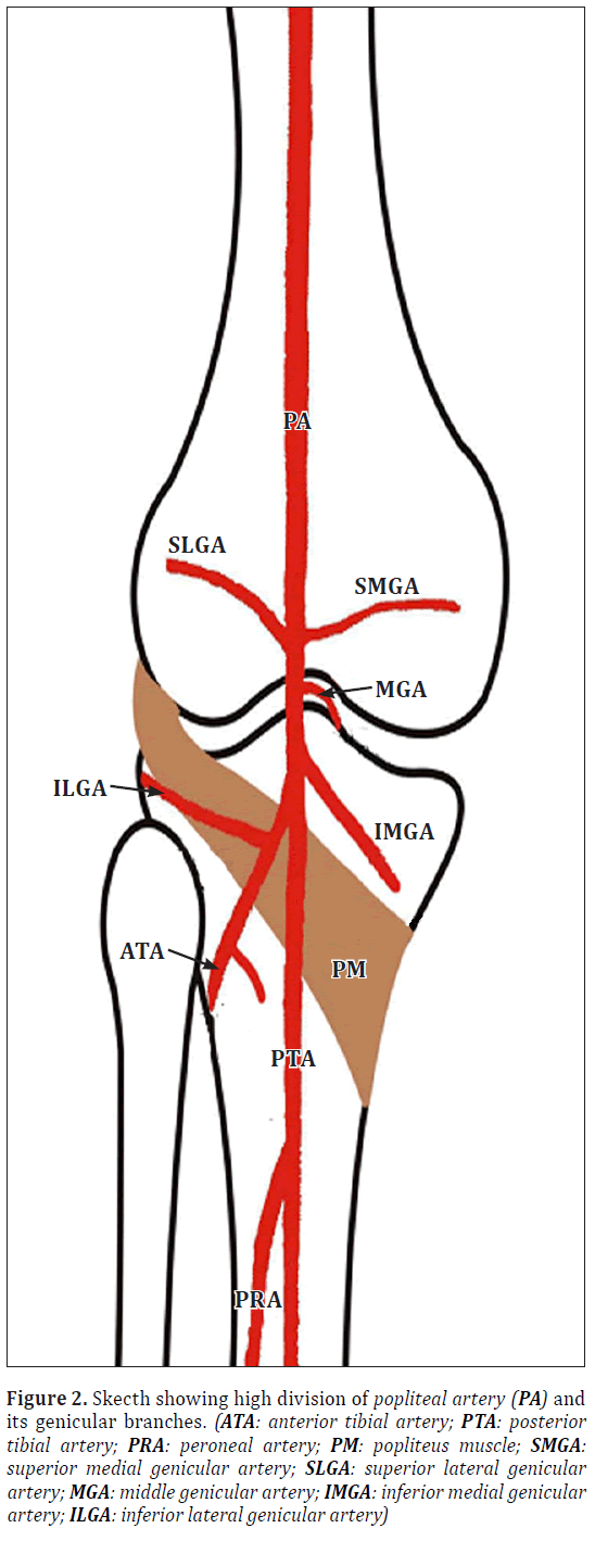 anatomical-variations-Skecth-showing