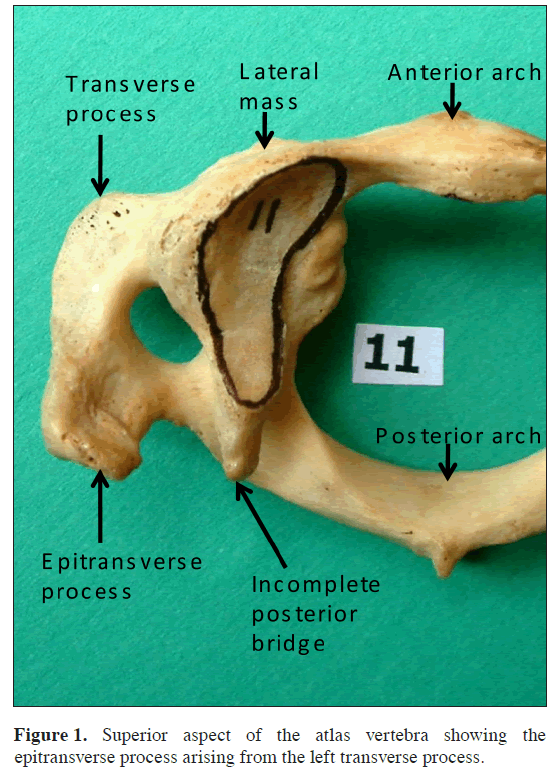 anatomical-variations-Superior-aspect