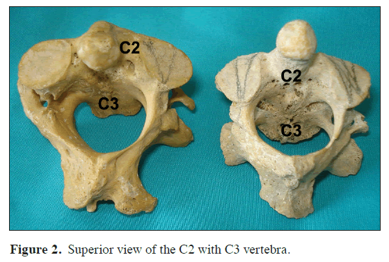 anatomical-variations-Superior-view