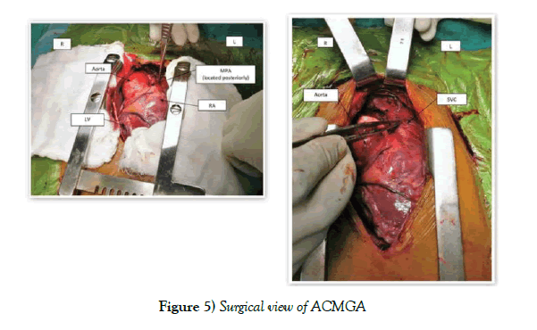 anatomical-variations-Surgical-view