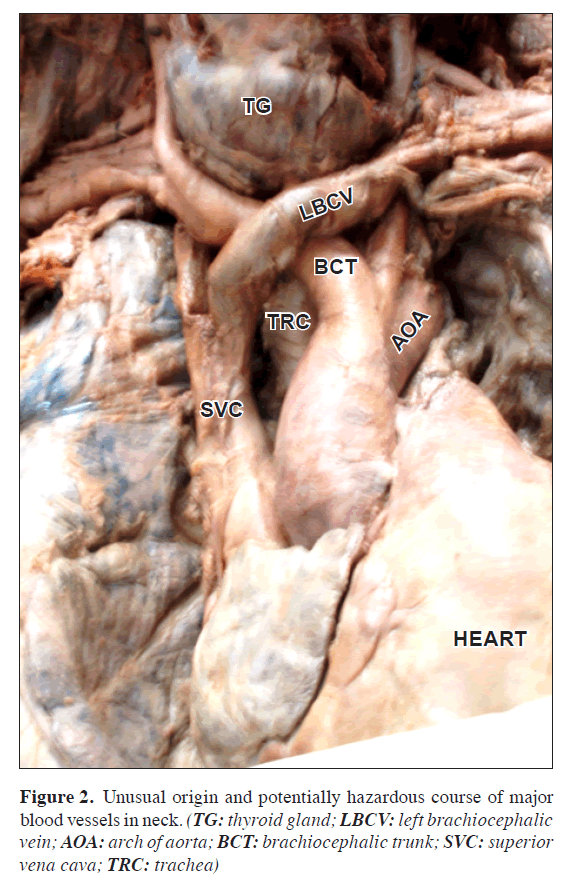 anatomical-variations-Unusual-origin