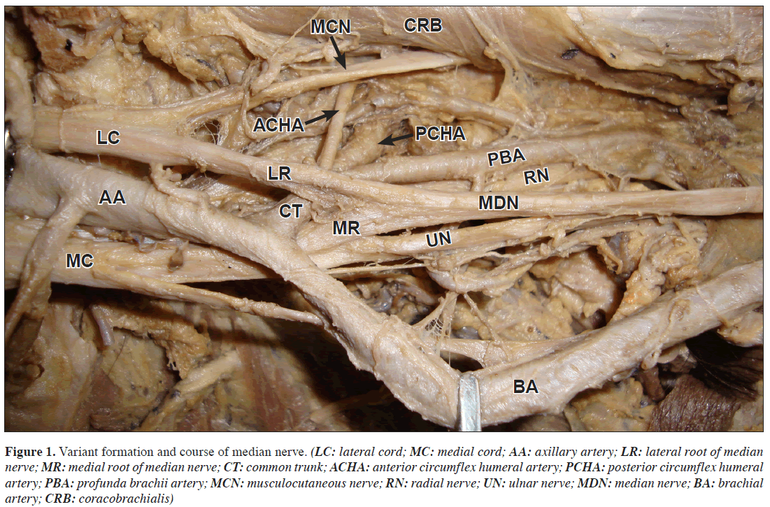 anatomical-variations-Variant-formation