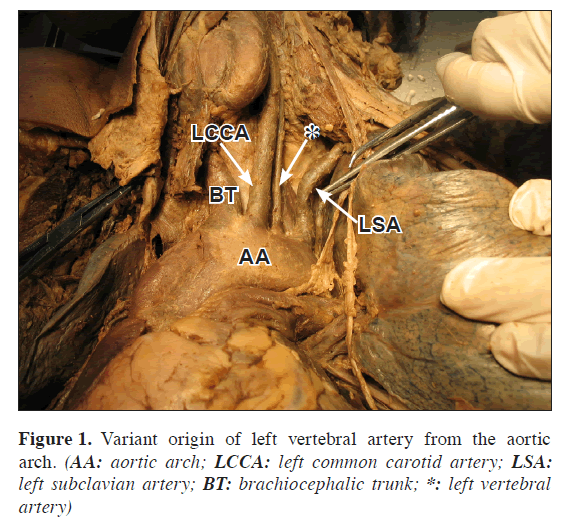 anatomical-variations-Variant-origin