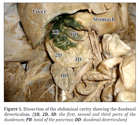 anatomical-variations-abdominal-cavity