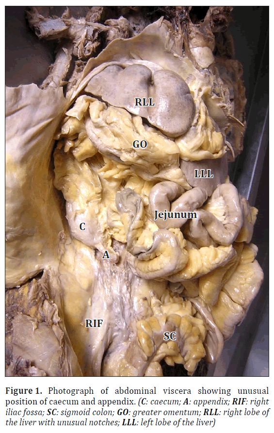 anatomical-variations-abdominal-viscera