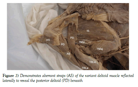 anatomical-variations-aberrant-straps