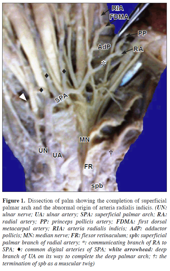 anatomical-variations-abnormal-origin