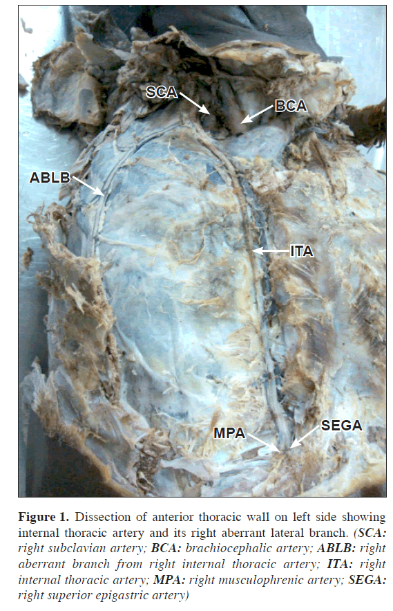 anatomical-variations-anterior-thoracic