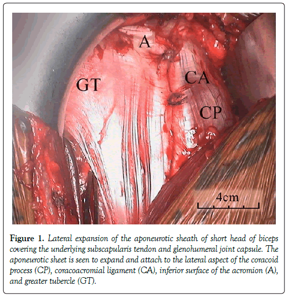 anatomical-variations-aponeurotic-sheath