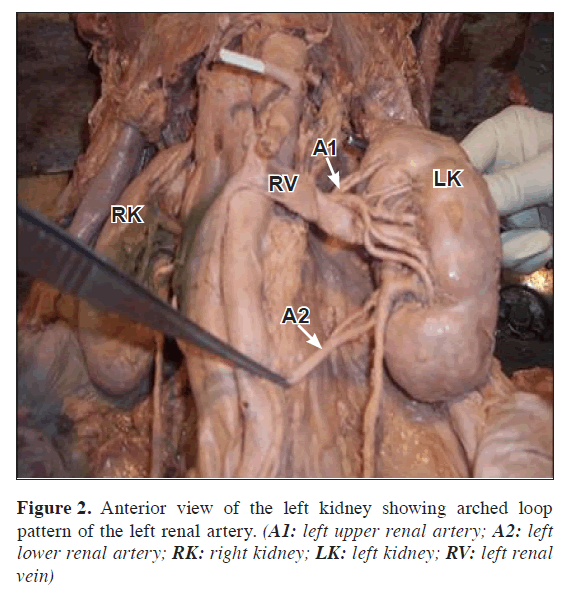 anatomical-variations-arched-loop