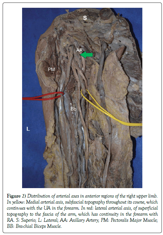 anatomical-variations-arterial-axes