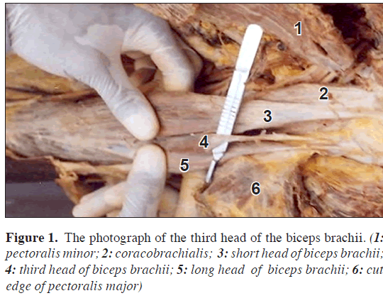 anatomical-variations-auricle