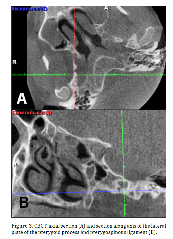 anatomical-variations-axial-section