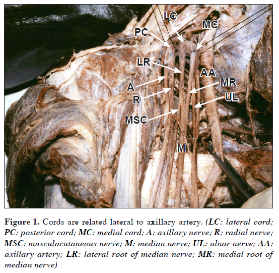 anatomical-variations-axillar-artery