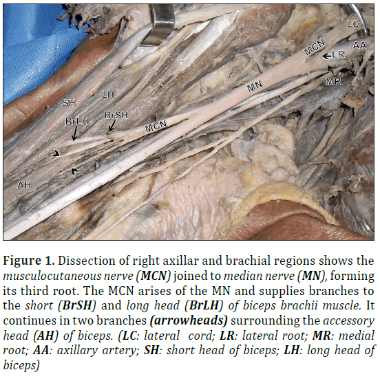 anatomical-variations-axillar-brachial