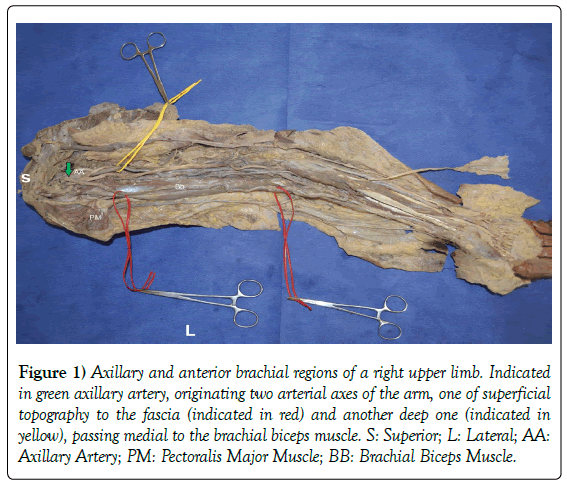 anatomical-variations-axillary-artery