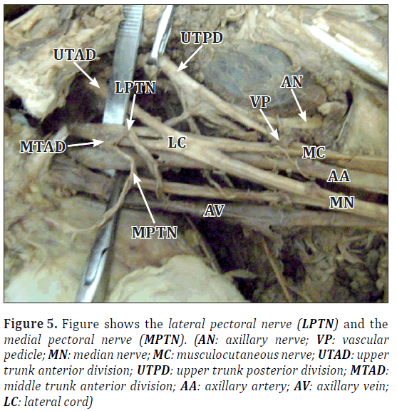 anatomical-variations-axillary-artery