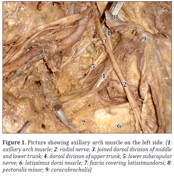 anatomical-variations-axillary-muscle