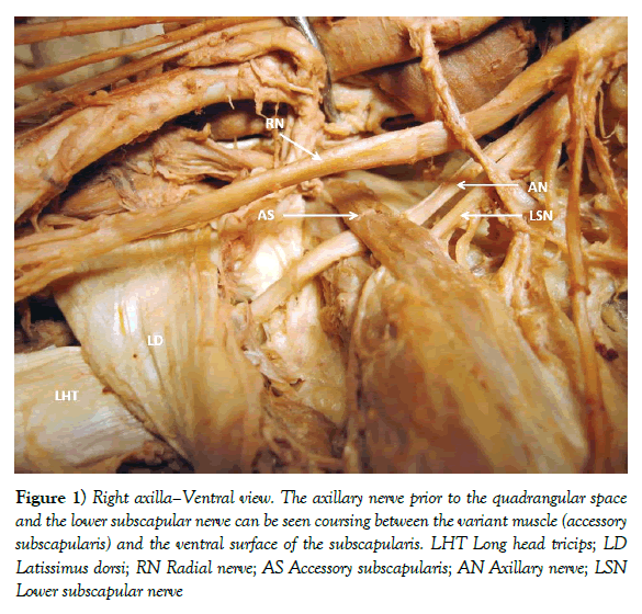 anatomical-variations-axillary-nerve