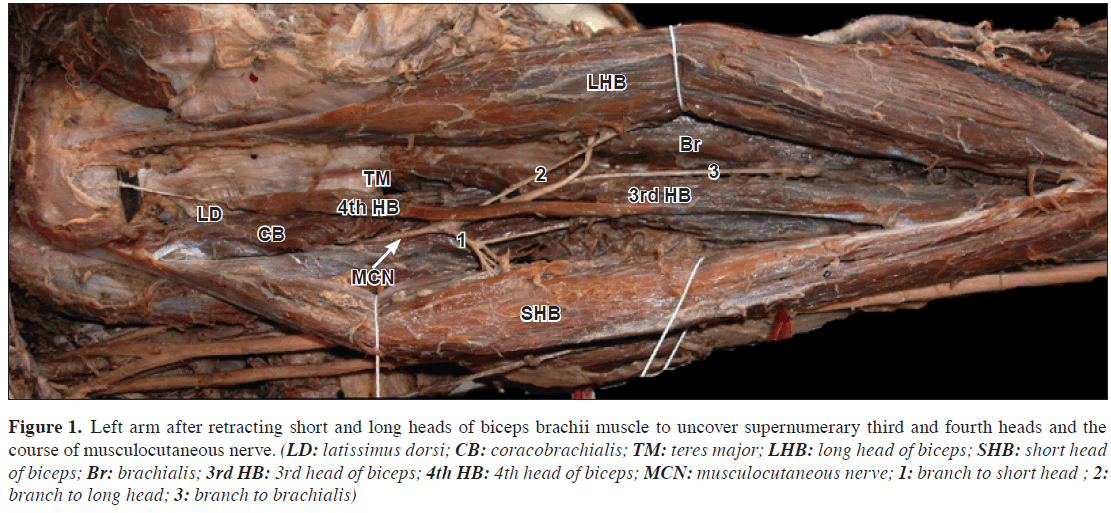 anatomical-variations-biceps