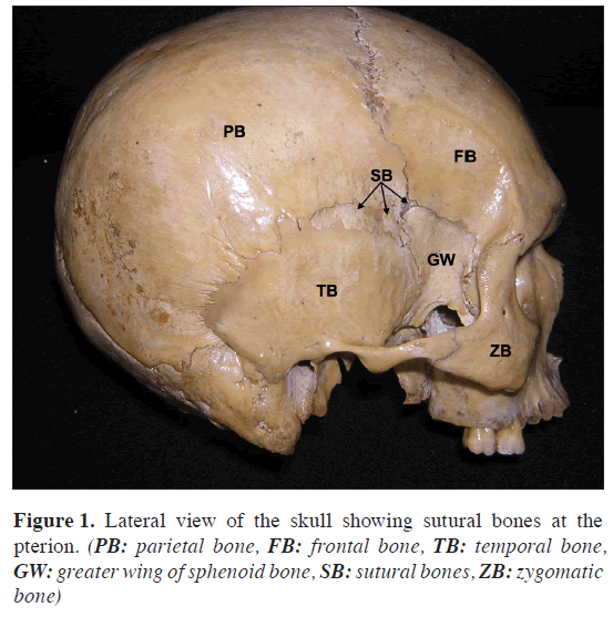 anatomical-variations-bones