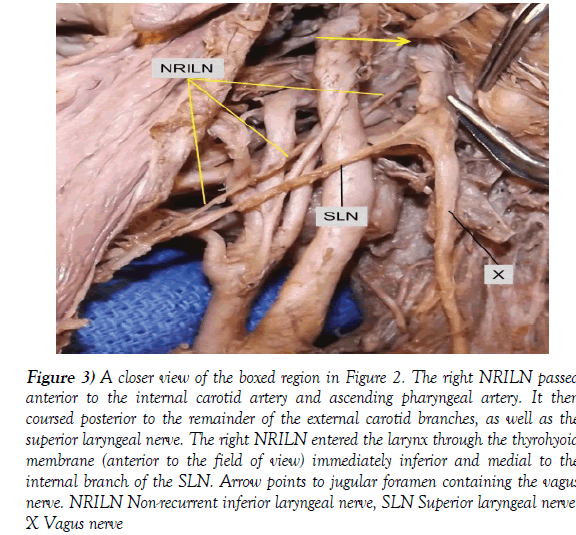 anatomical-variations-boxed